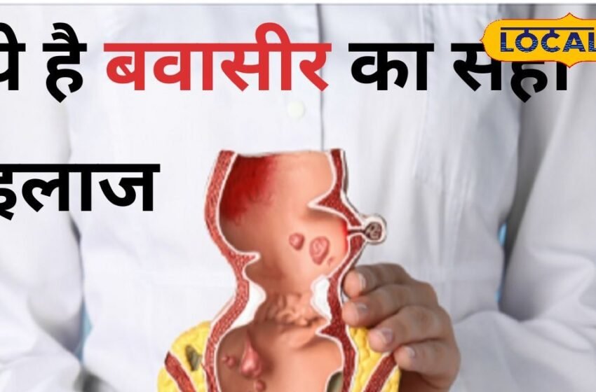  Piles Treatment: ना चीरा ना टांका, हकीम के बताए घरेलू नुस्खे दूर होगी बवासीर की समस्या, ये है उपाय